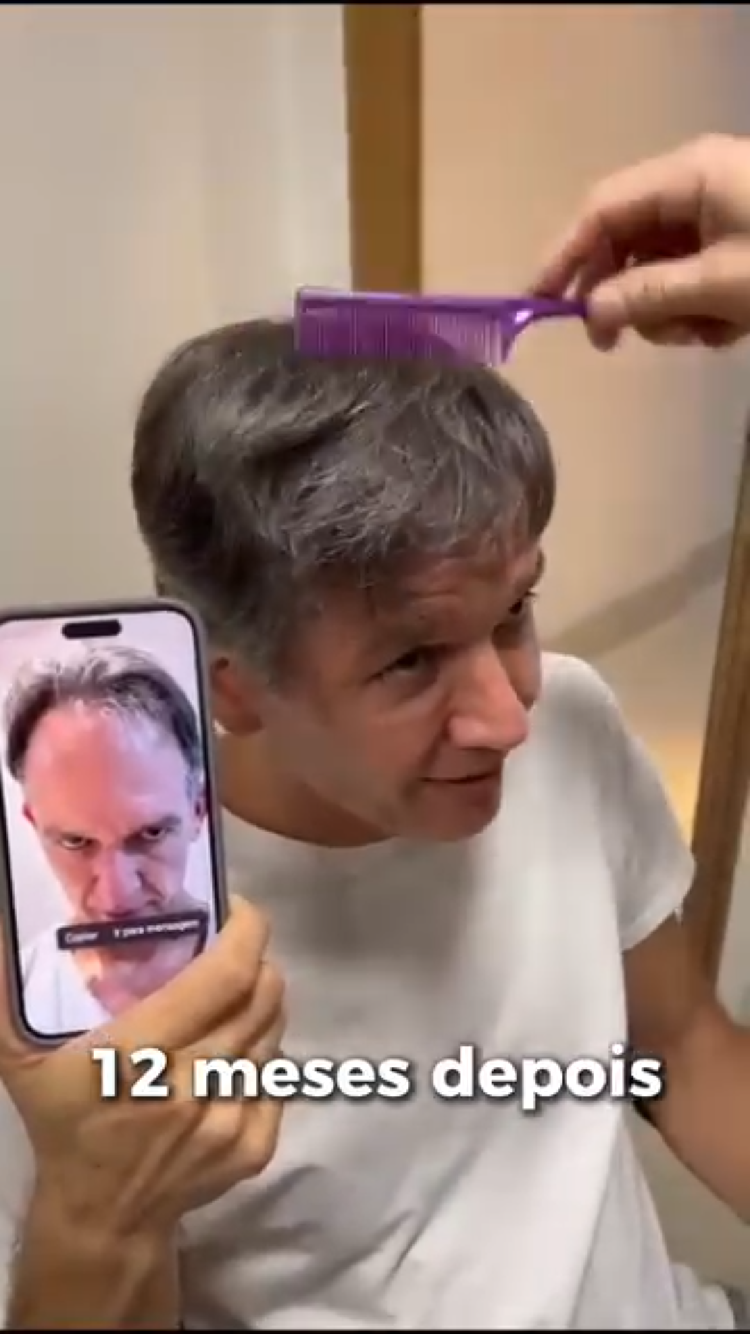 uploads/frames pro hair(4).png